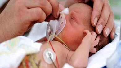 شایعترین بیماریهای چشمی در سنین مختلف شایعترین بیماریهای چشمی در سنین مختلف