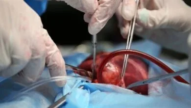 درج نشان «اهدای عضو» در گواهینامه‌های رانندگی