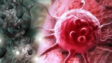 تغییر شرایط ادراری؛ مهمترین علامت سرطان پروستات تغییر شرایط ادراری؛ مهمترین علامت سرطان پروستات